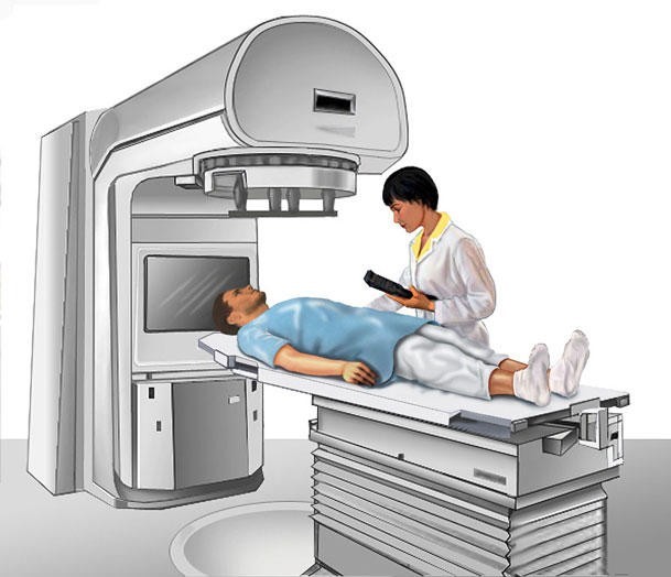 Radioterapia